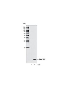 Cell Signaling Ccl5/Rantes (R40) Antibody