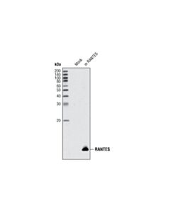 Cell Signaling Ccl5/Rantes Antibody