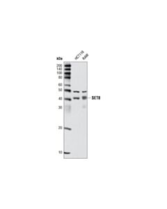 Cell Signaling Set8 (C18b7) Rabbit mAb