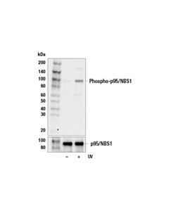 Cell Signaling Phospho-P95/Nbs1 (Ser343) Antibody
