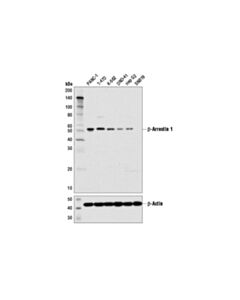 Cell Signaling Beta-Arrestin 1 (D7z3w) Xp Rabbit mAb