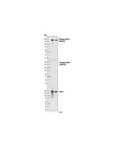 Cell Signaling Insulin Receptor Substrate Antibody Sampler Kit