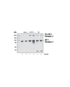 Cell Signaling IGF-I Receptor beta (111A9) Rabbit mAb 20 uL