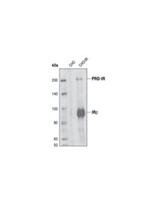 Cell Signaling Insulin Receptor beta (L55B10) Mouse mAb 20 uL