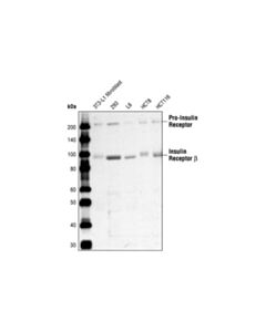 Cell Signaling Insulin Receptor Beta (4b8) Rabbit mAb