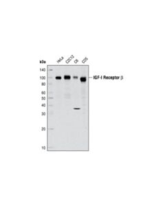 Cell Signaling Igf-I Receptor Beta Antibody