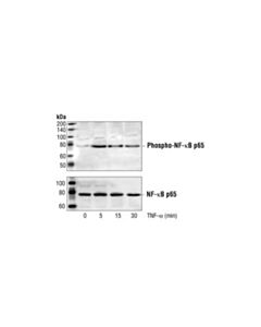 Cell Signaling Phospho-Nf-Kappab P65 (Ser536) Antibody