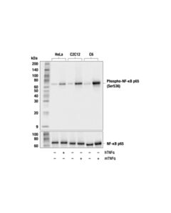 Cell Signaling Phospho-Nf-Kappab P65 (Ser536) (93h1) Rabbit mAb