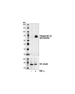 Cell Signaling Phospho-NF-kappaB p65 (Ser536) (7F1) Mouse Monoclonal Antibody
