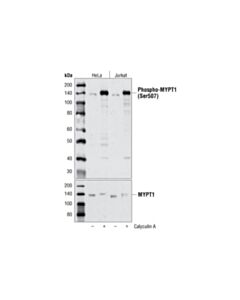 Cell Signaling Phospho-Mypt1 (Ser507) Antibody
