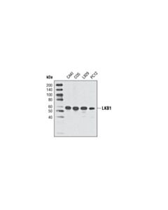 Cell Signaling Lkb1 (D60c5) Rabbit mAb