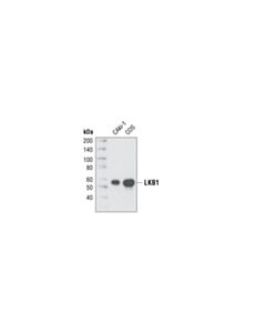 Cell Signaling Lkb1 (27d10) Rabbit mAb