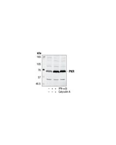 Cell Signaling Pkr Antibody