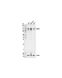Cell Signaling Rbm10 (E6i1r) Rabbit mAb