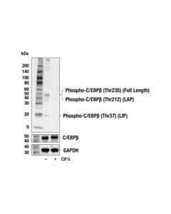 Cell Signaling Phospho-C/Ebpbeta (Thr235) Antibody