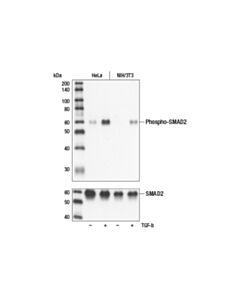 Cell Signaling Phospho-Smad2 (Ser465/467) (138d4) Rabbit mAb
