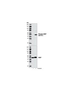 Cell Signaling Phospho-Vasp (Ser157) Antibody