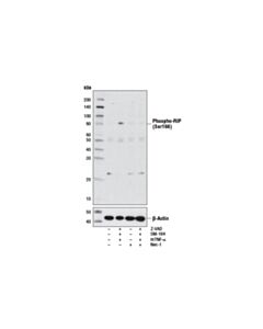 Cell Signaling Phospho-Rip (Ser166) Antibody (Rodent Specific) Apply) (Additional