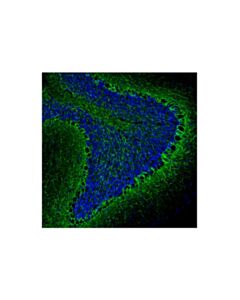 Cell Signaling Neurofilament-L (C28E10) Horse Chimeric mAb