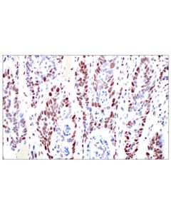 Cell Signaling C-Fos (E2i7r) Xp ® Rabbit mAb
