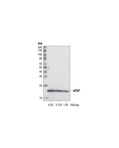 Cell Signaling Acidic FGF (11H11) Rabbit mAb 20 uL