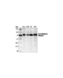 Cell Signaling Ezrin/Radixin/Moesin Antibody