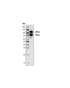 Cell Signaling Progesterone Receptor A/B (C89F7) Rabbit mAb 20 uL