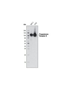 Cell Signaling Progesterone Receptor B (C1A2) Rabbit mAb 20 uL