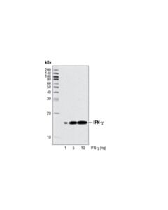 Cell Signaling IFN-gamma (3F1E3) Mouse mAb 20 uL