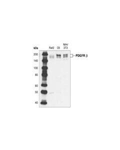 Cell Signaling PDGF Receptor beta (28E1) Rabbit Monoclonal Antibody