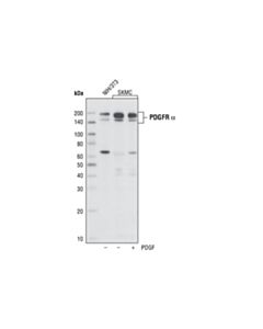 Cell Signaling Pdgf Receptor Alpha (D1e1e) Xp Rabbit mAb