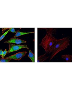 Cell Signaling NQO1 (A180) Mouse mAb 20 uL