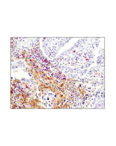 Cell Signaling Signalstain Boost Ihc Detection Reagent (Ap, Mouse)