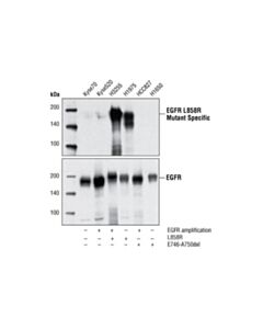 Cell Signaling Egf Receptor (L858r Mutant Specific) (43b2) Rabbit mAb