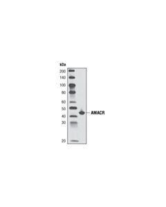 Cell Signaling AMACR (2A10) Mouse mAb 20 uL