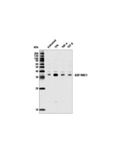 Cell Signaling Mic-1 (L300) Antibody