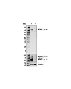 Cell Signaling Adar1 P150 Isoform Antibody
