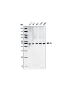Cell Signaling AP-2alpha (C83E10) Rabbit mAb 20 uL