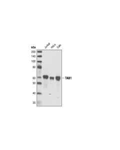 Cell Signaling TAB1 (C25E9) Rabbit mAb 20 uL
