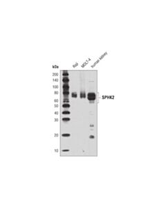 Cell Signaling SPHK2 (D2V3G) Rabbit mAb 20 uL