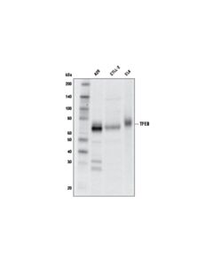 Cell Signaling Tfeb (D4l2p) Rabbit mAb