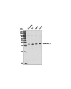 Cell Signaling Mic-1 (Y60) Antibody