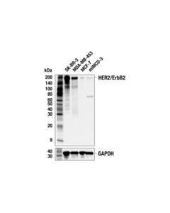 Cell Signaling Her2/Erbb2 (M45) Antibody