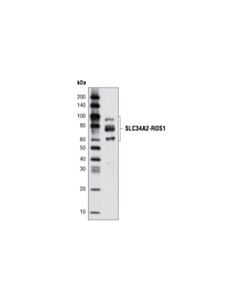 Cell Signaling ROS1 (69D6) Mouse mAb 20 uL