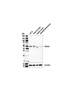 Cell Signaling Parkin (D4z1w) Rabbit mAb
