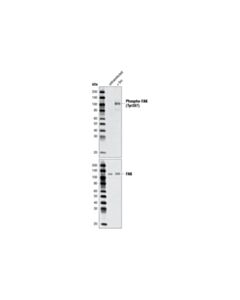Cell Signaling Phospho-Fak (Tyr397) Antibody