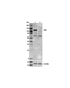 Cell Signaling Fak Antibody