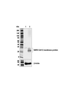 Cell Signaling SARS-CoV-2 Membrane Protein (E3V5H) Mouse mAb 20 uL
