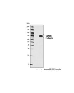 Cell Signaling Cd105/Endoglin Antibody (Mouse Specific)