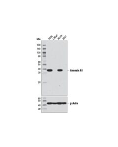 Cell Signaling Annexin A1 (D5v2t) Xp Rabbit mAb